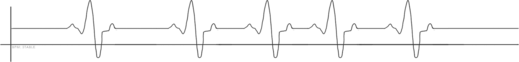 Heart rate illustration