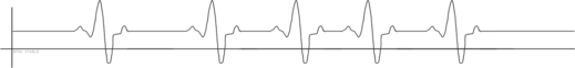 Image d'un rythme cardiaque